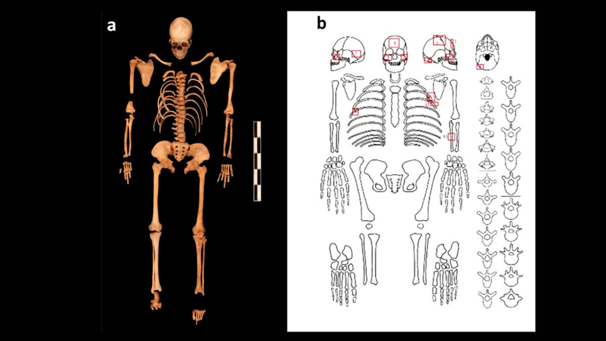 Kompletny szkielet mężczyzny z szybu rabunkowego (1) z zaznaczonymi obrażeniami, Shiyanzi, Chiny. Źródło: <a href='https://www.researchgate.net/publication/355356702_Hiding_a_leaf_in_the_forest_uncovering_a_1300-year-old_homicide_case_in_a_2000-year-old_cemetery' rel='noopener'>Archaeological and Anthropological Sciences</a>.