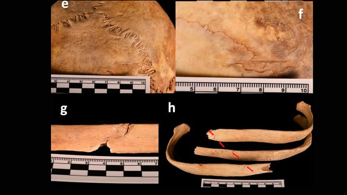 Urazy na czaszce (e,f) i żebrach (g,h) mężczyzny z szybu grobowca z Shiyanzi, Chiny. Źródło: <a href='https://www.researchgate.net/publication/355356702_Hiding_a_leaf_in_the_forest_uncovering_a_1300-year-old_homicide_case_in_a_2000-year-old_cemetery' rel='noopener'>Archaeological and Anthropological Sciences</a>.